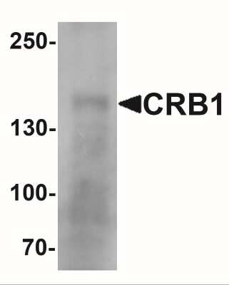 Western Blot: CRB1 AntibodyBSA Free [NBP2-41201]