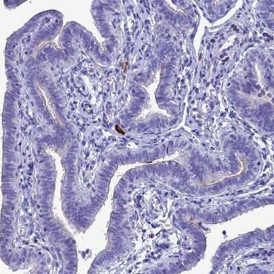 Immunohistochemistry-Paraffin: CRB2 Antibody [NBP1-91809]