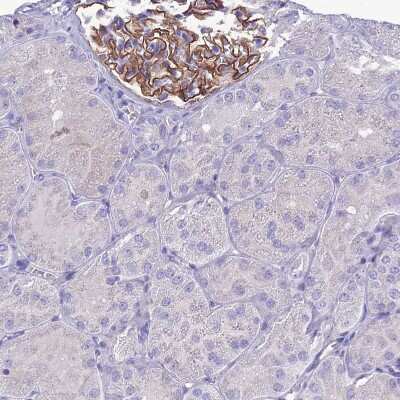 Immunohistochemistry-Paraffin: CRB2 Antibody [NBP1-91809]