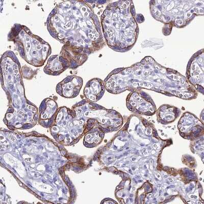 Immunohistochemistry-Paraffin: CRB2 Antibody [NBP1-91809]