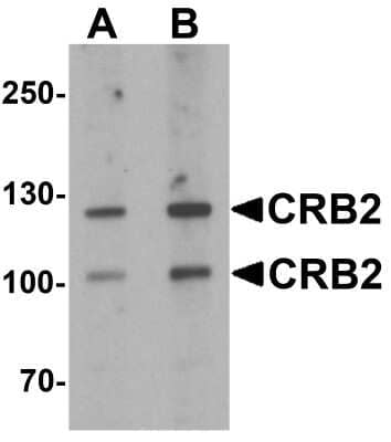 Western Blot: CRB2 AntibodyBSA Free [NBP2-81710]