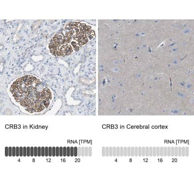 Immunohistochemistry-Paraffin: CRB3 Antibody [NBP1-81185]