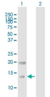 Western Blot: CRB3 Antibody [H00092359-B01P]