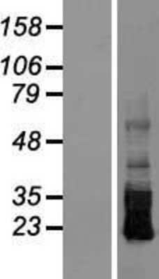 Western Blot: CRB3 Overexpression Lysate [NBP2-05070]