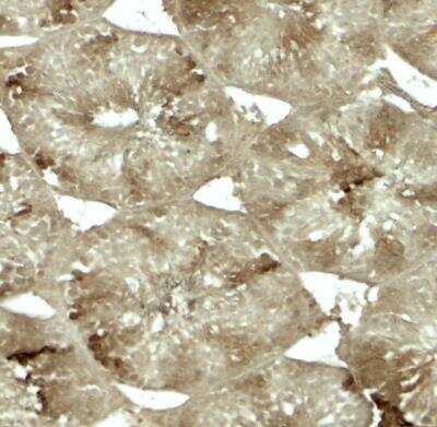 Immunohistochemistry: CRBN Antibody - BSA Free [NBP2-82079]