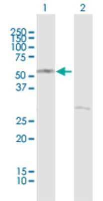 Western Blot: CRBN Antibody [H00051185-B01P]