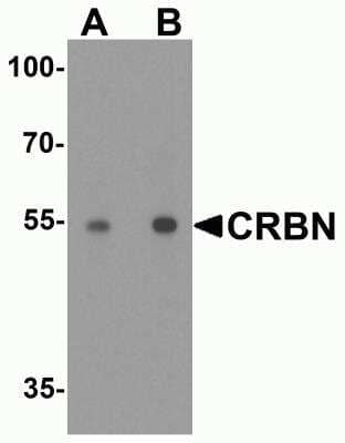 Western Blot: CRBN AntibodyBSA Free [NBP2-82079]