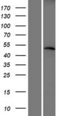 Western Blot: CRBN Overexpression Lysate [NBP2-07061]