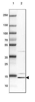 Western Blot: CRCP Antibody [NBP1-84495]