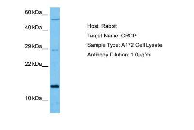 Western Blot: CRCP Antibody [NBP2-82757]