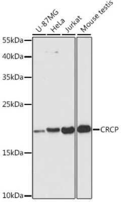 Western Blot: CRCP AntibodyAzide and BSA Free [NBP2-92783]