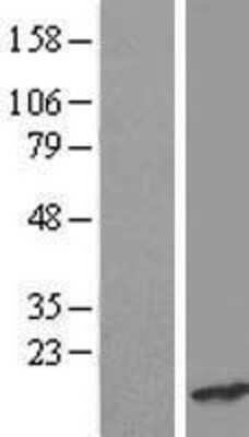 Western Blot: CRCP Overexpression Lysate [NBL1-15249]