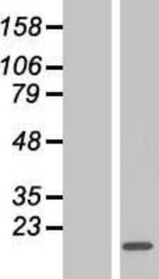 Western Blot: CRCP Overexpression Lysate [NBP2-07323]