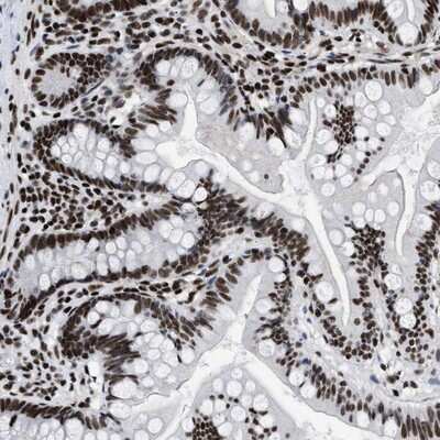 Immunohistochemistry-Paraffin: CREB Antibody [NBP1-90364]