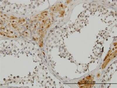 Immunohistochemistry-Paraffin: CREB3 Antibody (3H5) [H00010488-M01]