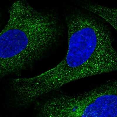 Immunocytochemistry/ Immunofluorescence: CREB3 Antibody [NBP2-58307]