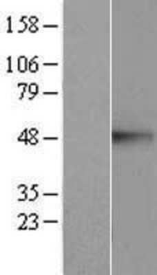 Western Blot: CREB3 Overexpression Lysate [NBP2-07628]