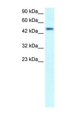Western Blot: CREB3 regulatory factor Antibody [NBP1-79997]