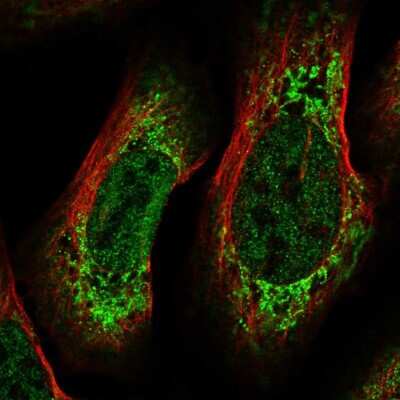 Immunocytochemistry/ Immunofluorescence: CREB3L2 Antibody [NBP2-58761]