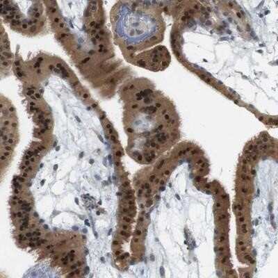 Immunohistochemistry-Paraffin: CREB3L2 Antibody [NBP1-88697]
