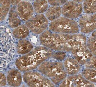 Immunohistochemistry-Paraffin: CREB3L2 Antibody [NBP1-88697]