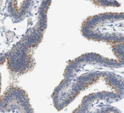 Immunohistochemistry-Paraffin: CREB3L2 Antibody [NBP1-88697]