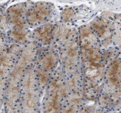 Immunohistochemistry-Paraffin: CREB3L2 Antibody [NBP1-88697]