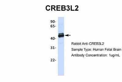 Western Blot: CREB3L2 Antibody [NBP2-87208]