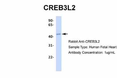 Western Blot: CREB3L2 Antibody [NBP2-87208]