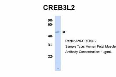 Western Blot: CREB3L2 Antibody [NBP2-87208]