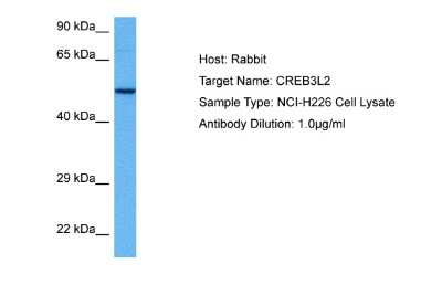 Western Blot: CREB3L2 Antibody [NBP2-87209]