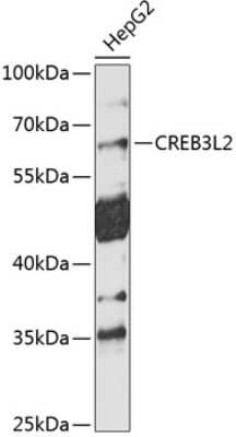 Western Blot: CREB3L2 AntibodyBSA Free [NBP2-92030]