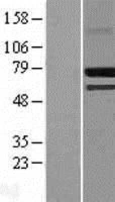 Western Blot: CREB3L2 Overexpression Lysate [NBL1-09465]