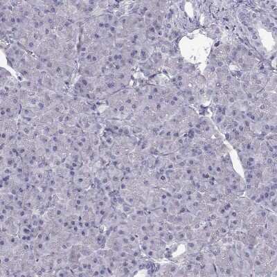 Immunohistochemistry-Paraffin: CREB3L3 Antibody [NBP2-13873]