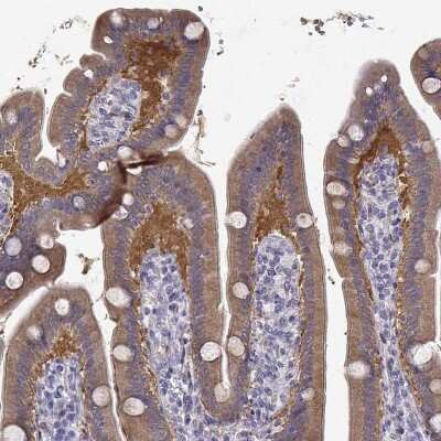 Immunohistochemistry-Paraffin: CREB3L3 Antibody [NBP2-13873]