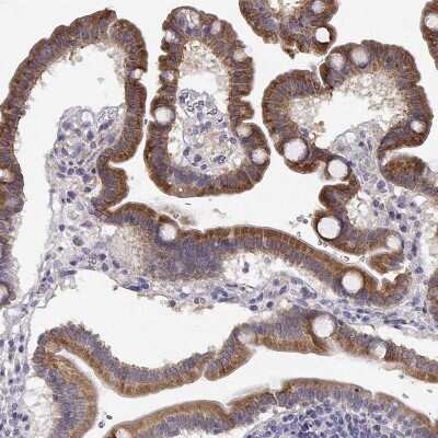 Immunohistochemistry-Paraffin: CREB3L3 Antibody [NBP2-38785]