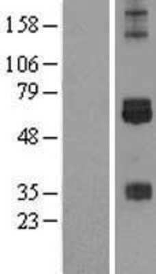 Western Blot: CREB3L3 Overexpression Lysate [NBL1-09466]