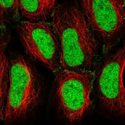 Immunocytochemistry/ Immunofluorescence: CREB5 Antibody [NBP2-56912]