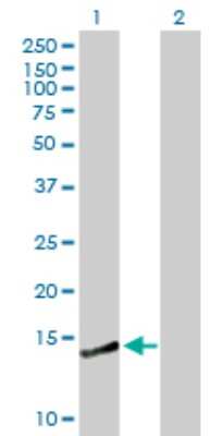 Western Blot: CREBL2 Antibody [H00001389-B01P]