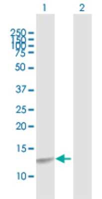 Western Blot: CREBL2 Antibody [H00001389-D01P]