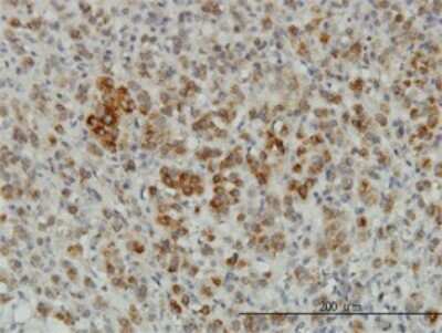 Immunohistochemistry-Paraffin: CREG Antibody (1B7) [H00008804-M01]