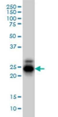 Western Blot: CREG Antibody (1B7) [H00008804-M01]