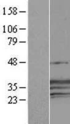 Western Blot: CREG Overexpression Lysate [NBL1-09468]