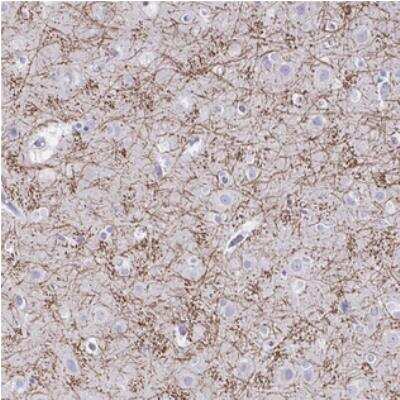 Immunohistochemistry: CREG2 Antibody [NBP1-86262]