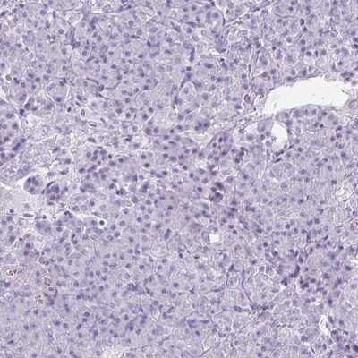 Immunohistochemistry-Paraffin: CREG2 Antibody [NBP1-86262]