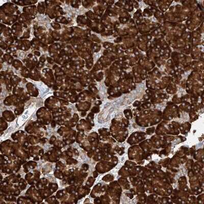 Immunohistochemistry-Paraffin: CRELD1 Antibody [NBP1-88917]