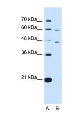 Western Blot: CRELD1 Antibody [NBP1-59928]