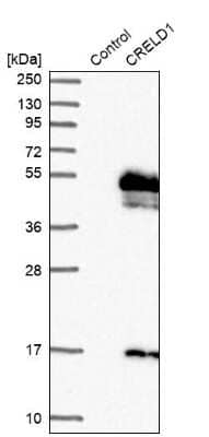 Western Blot: CRELD1 Antibody [NBP1-88917]