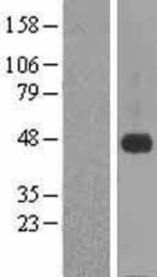 Western Blot: CRELD1 Overexpression Lysate [NBL1-09469]