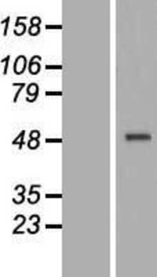 Western Blot: CRELD1 Overexpression Lysate [NBP2-07161]